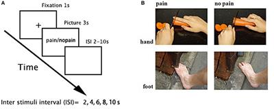 Effects of Acute Alcohol Intoxication on Empathic Neural Responses for Pain